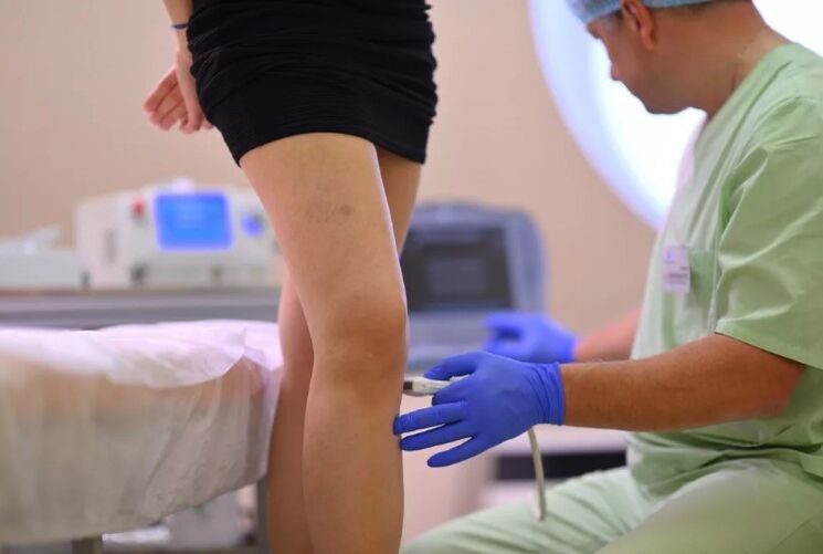 ultrasound diagnosis of varicose veins